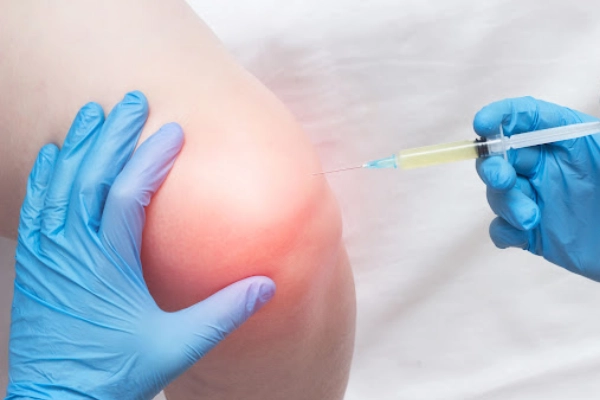 Interventional Pain Management